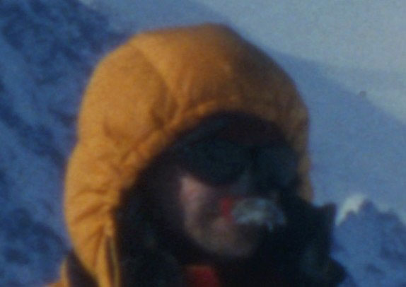Scannet bilde